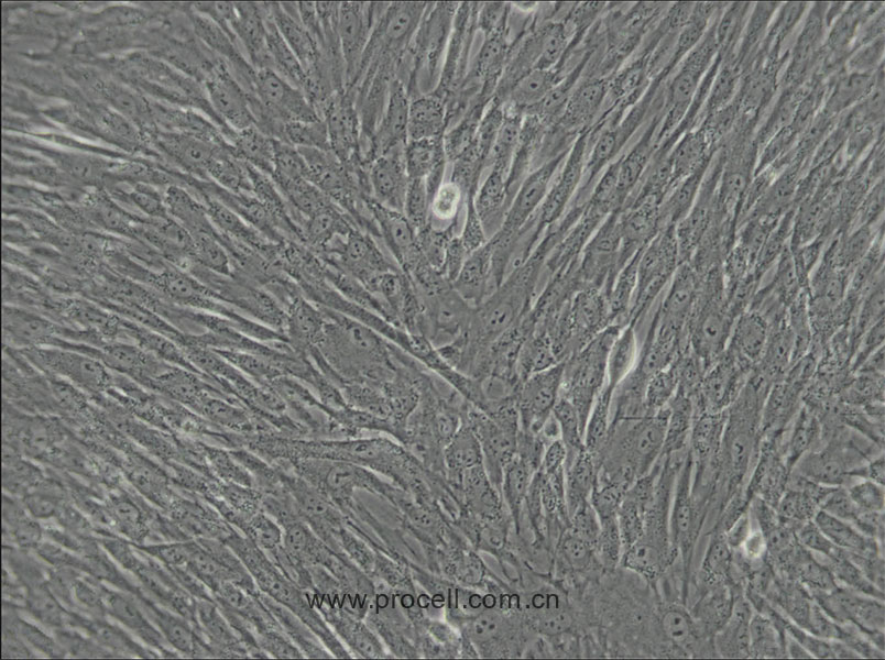 人脐带间充质干细胞