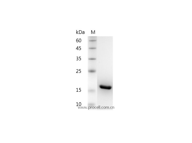 IL-1β/IL1F2, Human, Recombinant
