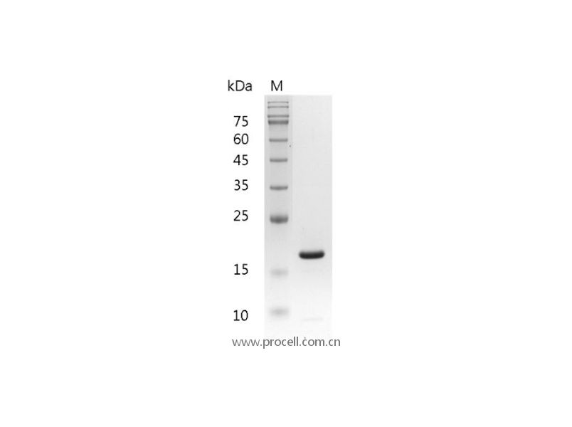 IL-1β/IL1F2, Mouse, Recombinant