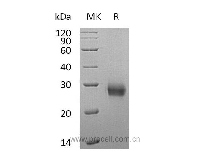 Procell-RANK/ TNFRSF11A/ CD265 (C-6His), Human, Recombinant
