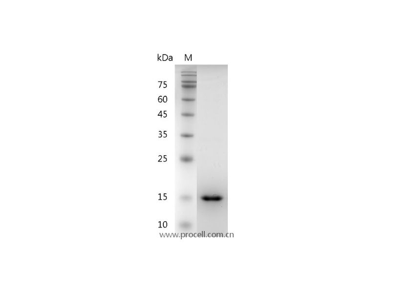GDNF/ATF/HSCR3, Human, Recombinant