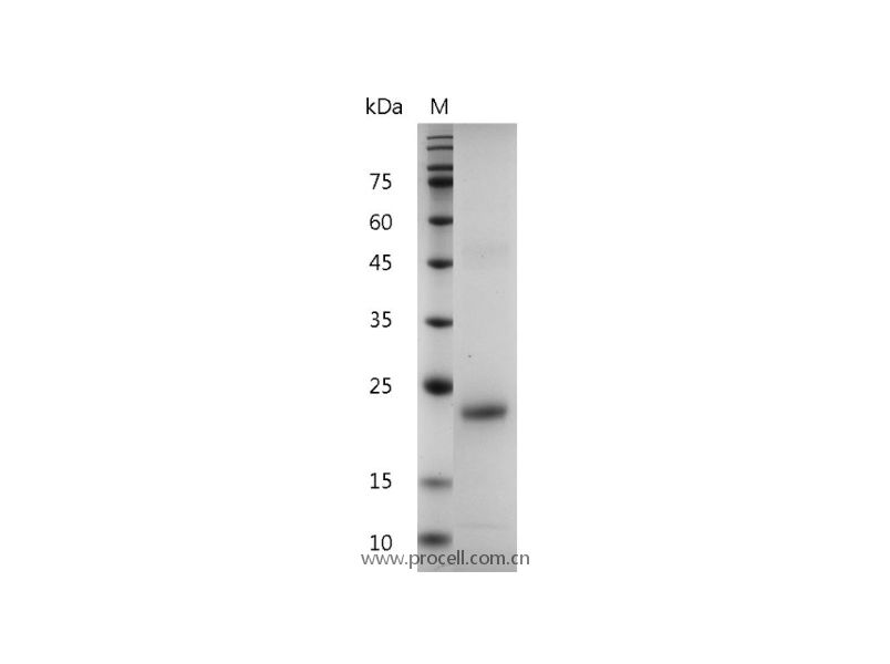 IL-6/IFN-β2/BSF-2, Human, Recombinant