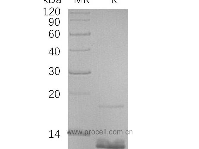 Procell-MIP-4/ CCL18 (N-6His), Human, Recombinant
