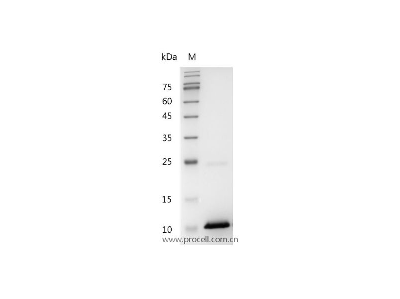 CXCL10/IP-10/Crg-2, Human, Recombinant