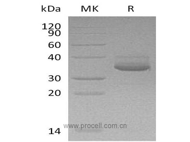 Procell-IP-10/ CRG-2/ CXCL10 (C-Fc-6His), Human, Recombinant