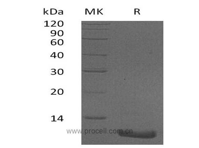 GRO-β/ CINC-3/ CXCL2, Human, Recombinant