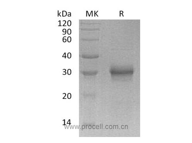 Procell-FGF-17 (C-6His), Human, Recombinant