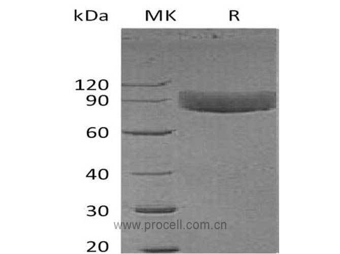 Procell-IL-1R-1/ CD121a (C-Fc), Human, Recombinant