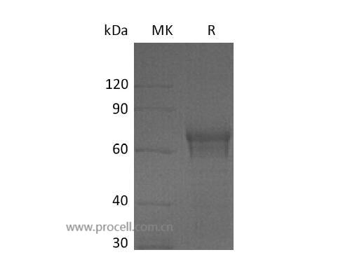 IL-15RA/ CD215 (C-Fc), Human, Recombinant