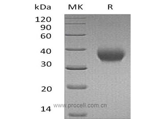 IL-2RB/ CD122 (C-6His), Human, Recombinant