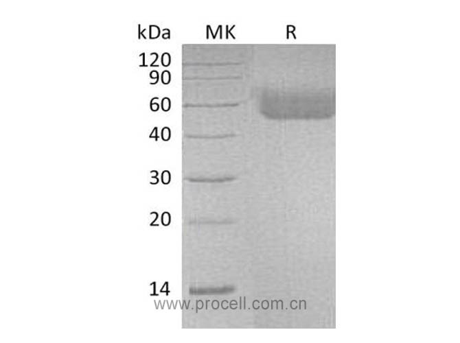 Procell-IL-1R-1/ CD121a, Human, Recombinant
