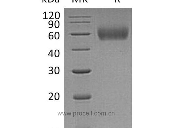 Procell-IL-1R-2/ CD121b, Human, Recombinant