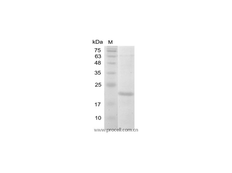 IL-38/IL-1F10/IL-1HY2, Human, Recombinant
