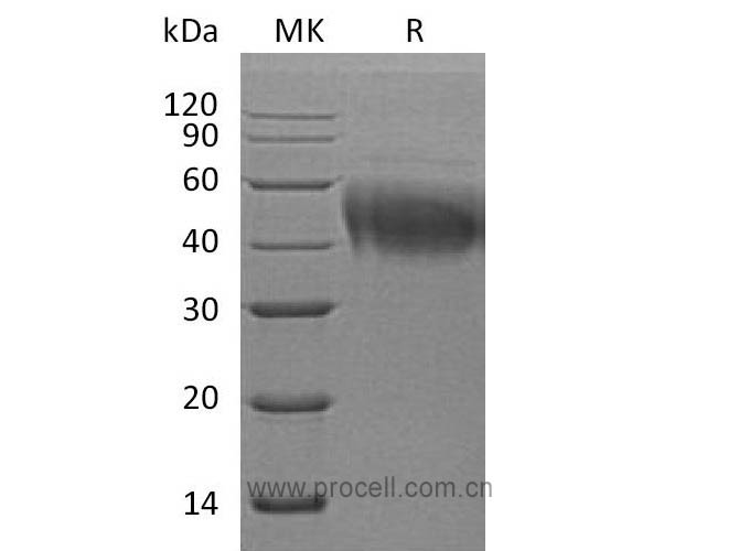 IL-4Rα/ CD124 (C-6His), Human, Recombinant