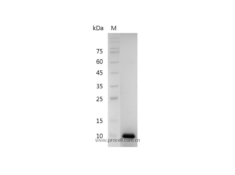 IL-8/MDNCF/NAF/CXCL8, Human, Recombinant