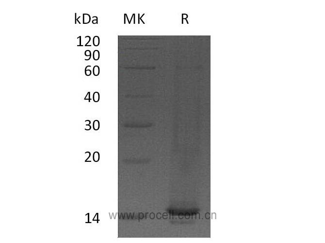 MIP-1γ/ CCL9, Mouse, Recombinant