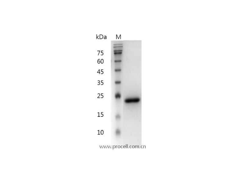 IL-6/IFN-β2/BSF-2/HPGF/HSF, Mouse, Recombinant