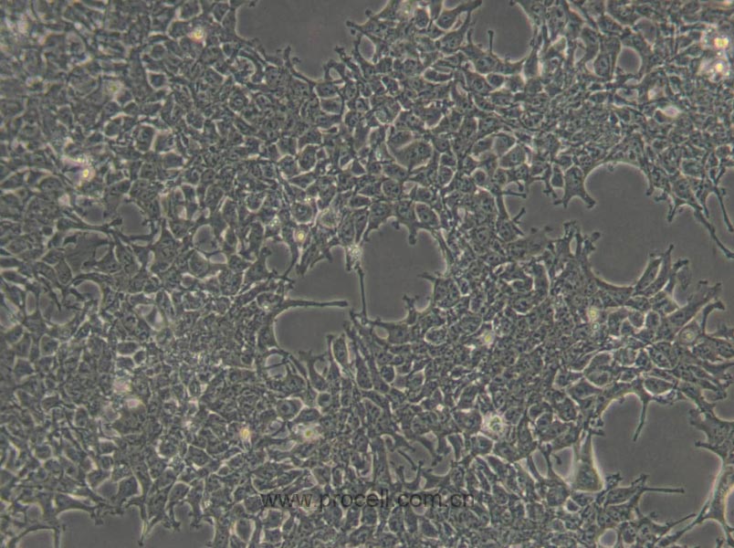AAV-293 (人胚肾细胞) (STR鉴定正确)