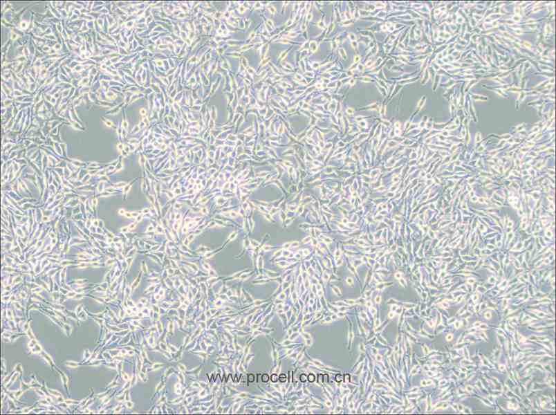 B16 (小鼠黑色素瘤细胞) (种属鉴定正确)