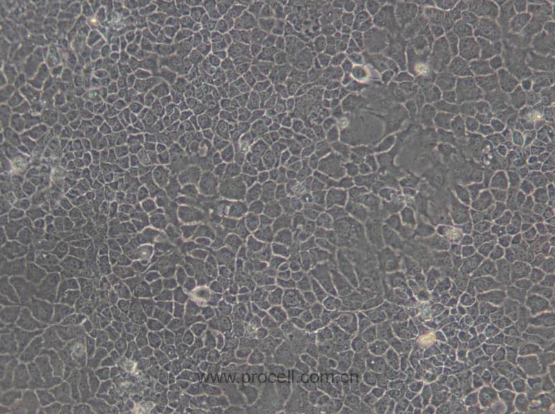BNL CL.2 (小鼠胚胎肝细胞) (STR鉴定正确)