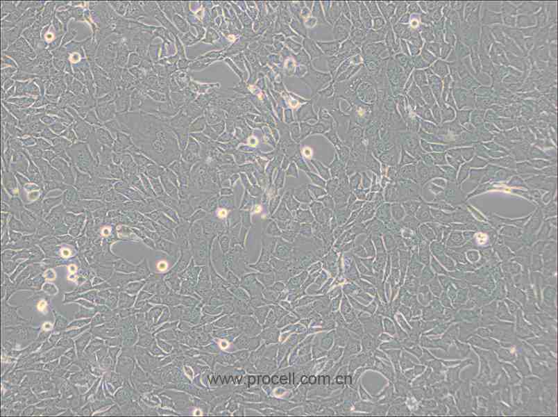 C127 [C-127] (小鼠乳腺肿瘤细胞) (种属鉴定正确)