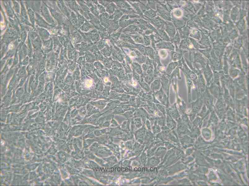 C2C12 (小鼠成肌细胞) (STR鉴定正确)