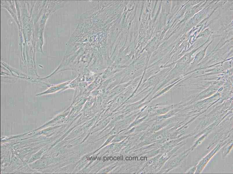 CCD-1095Sk (人乳腺浸润性导管癌旁皮肤细胞) (STR鉴定正确)