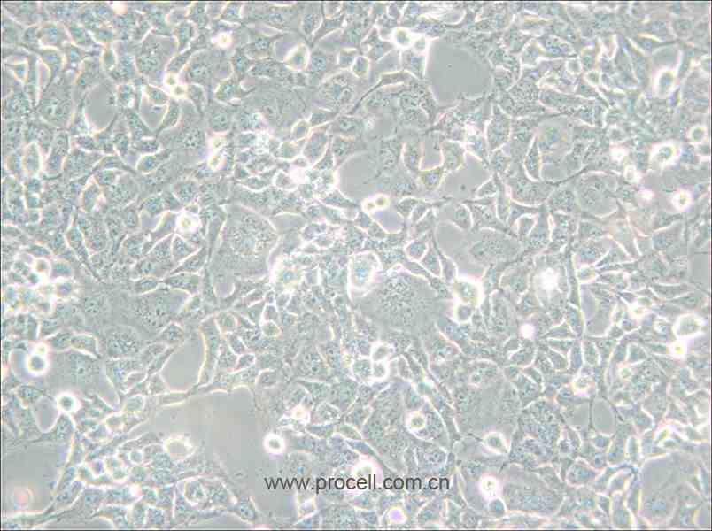 COS-1 (非洲绿猴SV40转化的肾细胞) (种属鉴定正确)