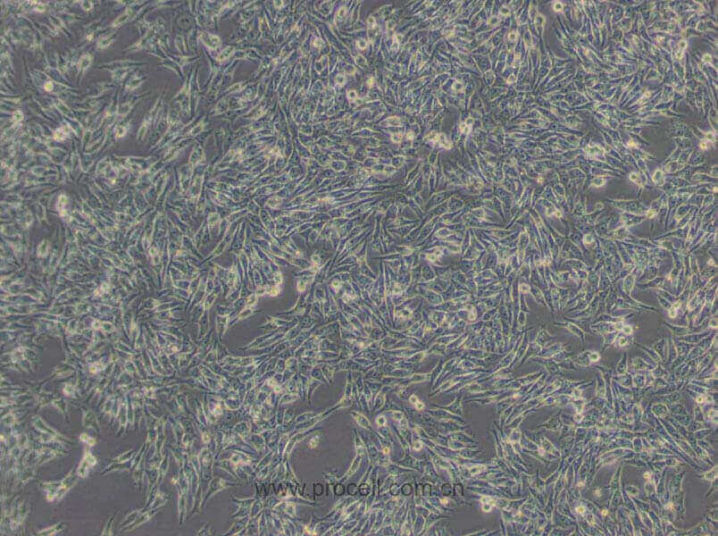 HGC-27 (人胃癌细胞(未分化)) (STR鉴定正确)