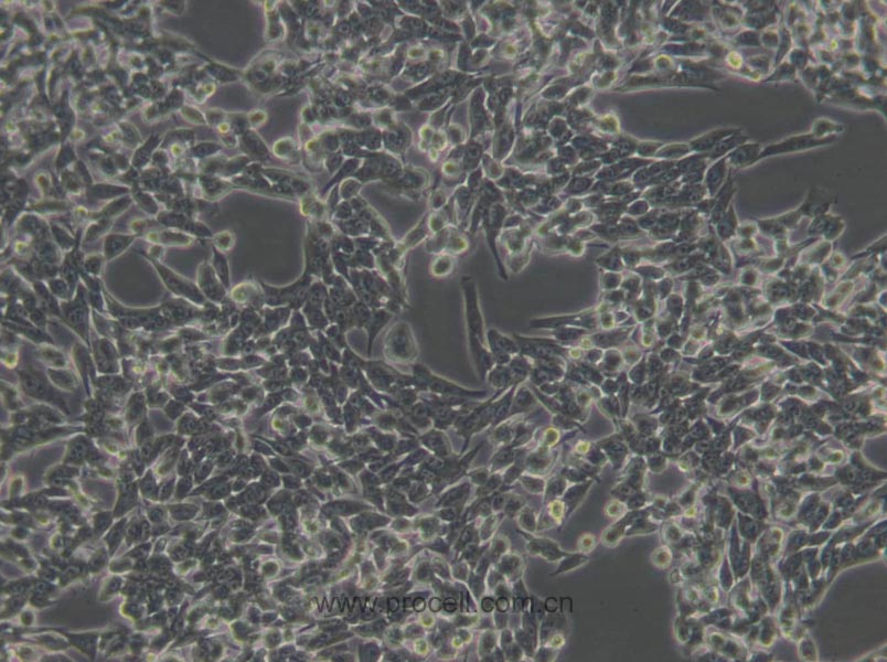 HSC-T6 (大鼠肝星形细胞) (种属鉴定正确)