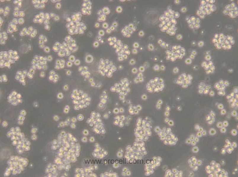 Jurkat, Clone E6-1 (人T淋巴细胞白血病细胞) (STR鉴定正确)