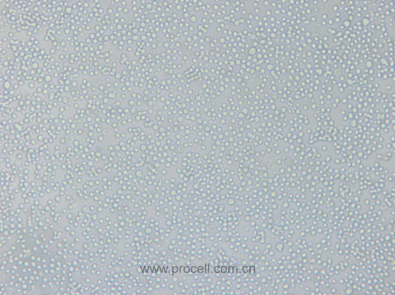 L1210 (小鼠白血病细胞) (STR鉴定正确)