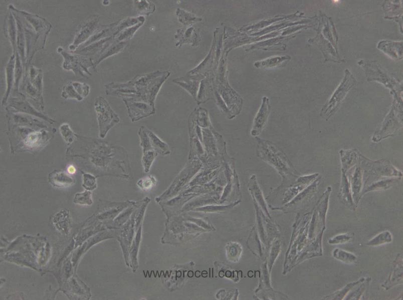 L6 (大鼠成肌细胞) (种属鉴定正确)
