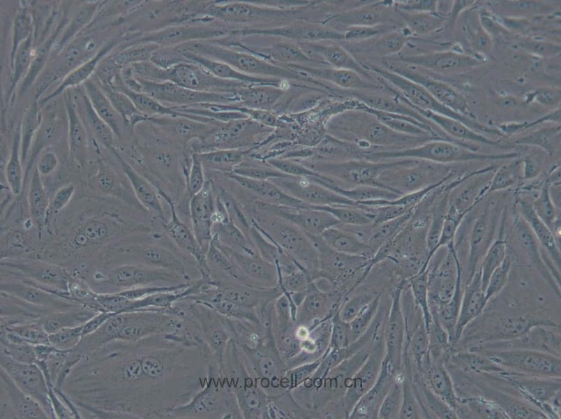 MS1 (小鼠胰岛内皮细胞) (STR鉴定正确)