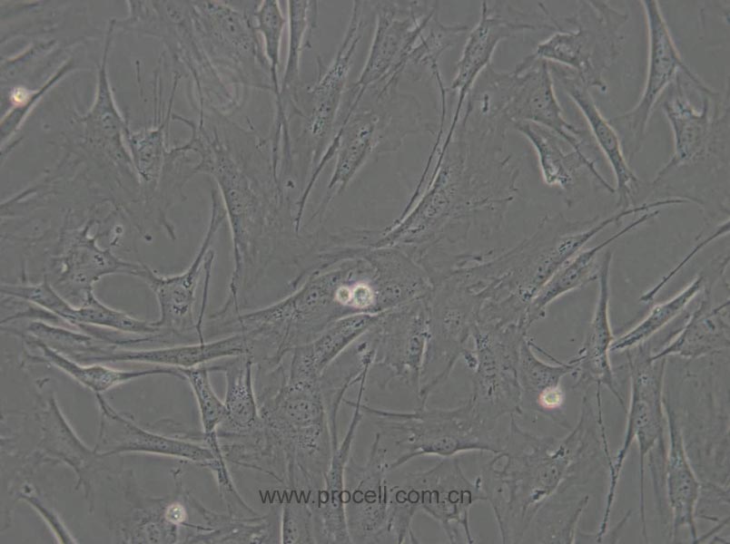 OP9 (小鼠骨髓基质细胞) (STR鉴定正确)