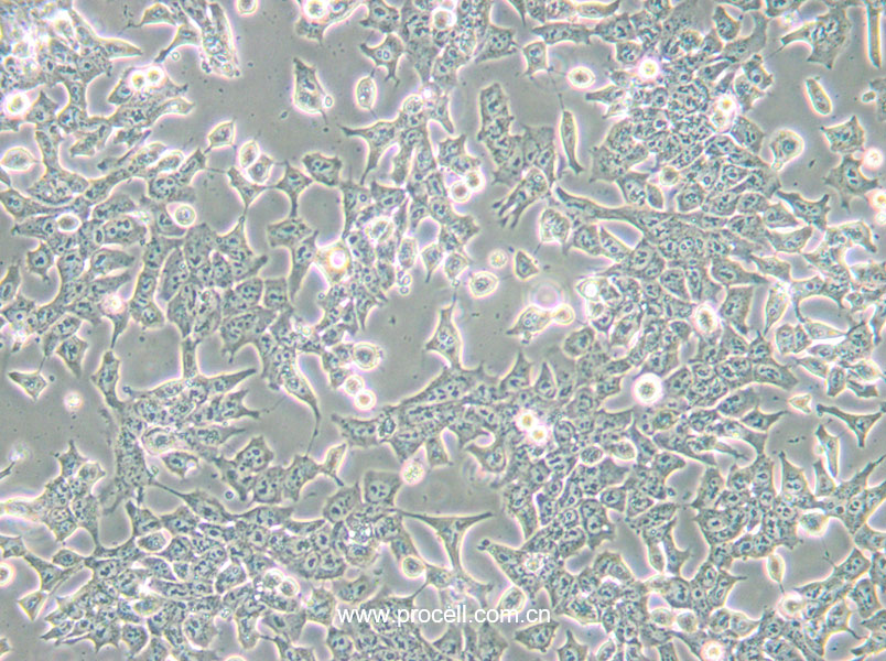 P19 [P-19] (小鼠畸胎瘤细胞) (STR鉴定正确)