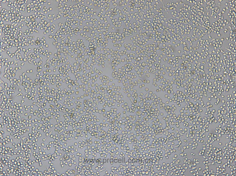 P815 (小鼠肥大细胞瘤细胞) (STR鉴定正确)