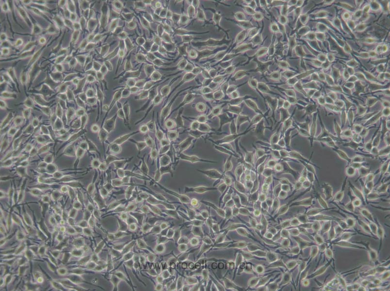 RBL-2H3 (大鼠嗜碱性细胞白血病细胞) (种属鉴定正确)