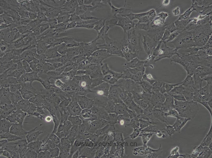 RF/6A (猴脉络膜-视网膜内皮细胞) (种属鉴定正确)
