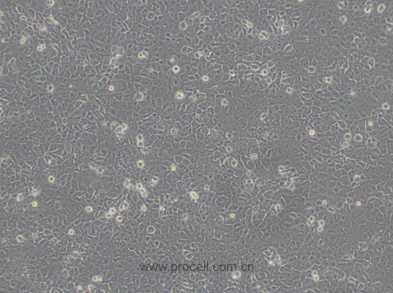 T24 [T-24] (人膀胱移行细胞癌细胞) (STR鉴定正确)