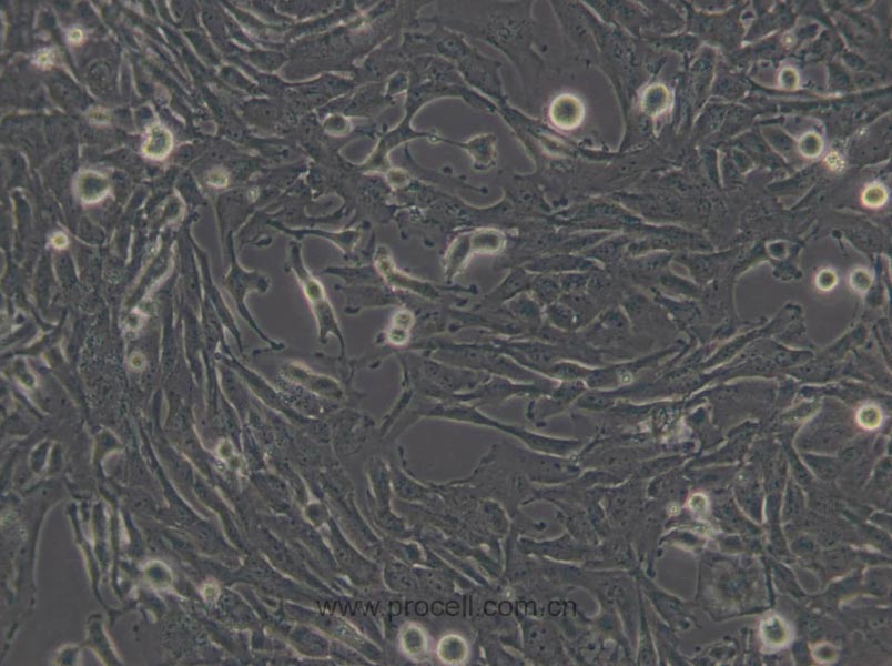 U251 (人胶质瘤细胞) (STR鉴定正确)