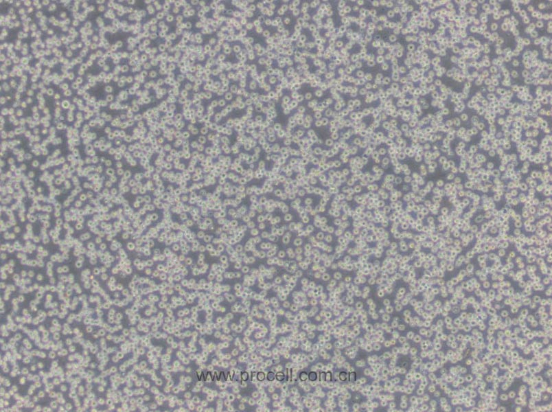 NFS-60 (小鼠髓性白血病淋巴细胞) (STR鉴定正确)