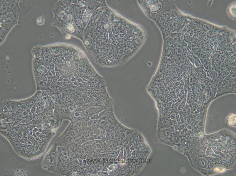 SW1116 (人结肠腺癌细胞) (STR鉴定正确)
