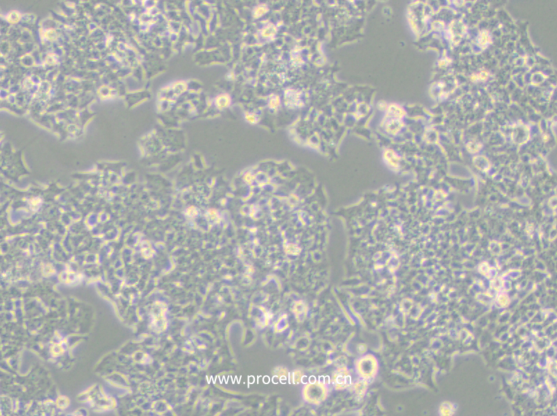 NCI-H520 (人肺鳞癌细胞) (STR鉴定正确)