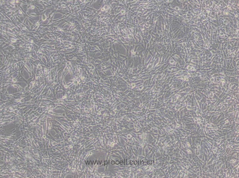 TM4 (正常小鼠睾丸Sertoli细胞) (STR鉴定正确)