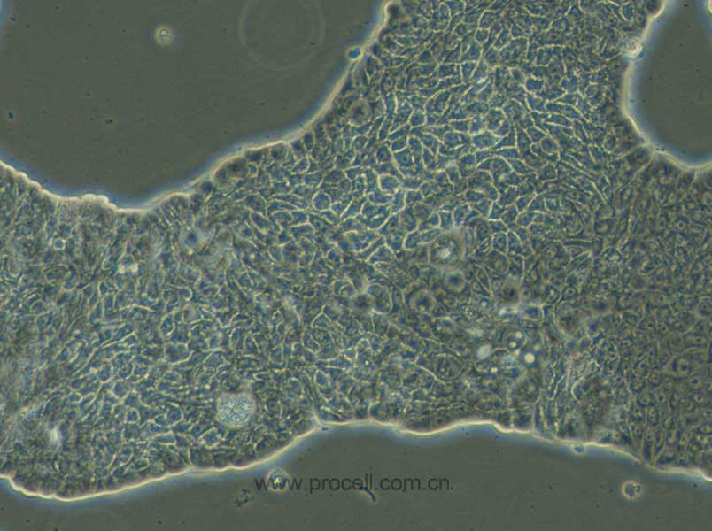 UACC-812 (人乳腺导管瘤细胞)(STR鉴定正确)