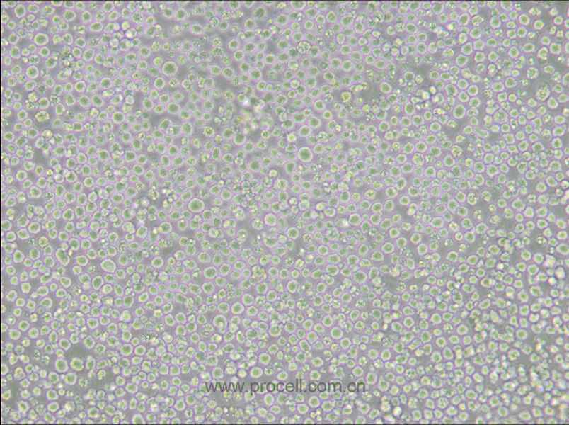AE-1 (小鼠杂交瘤细胞(抗AChE)) (种属鉴定正确)