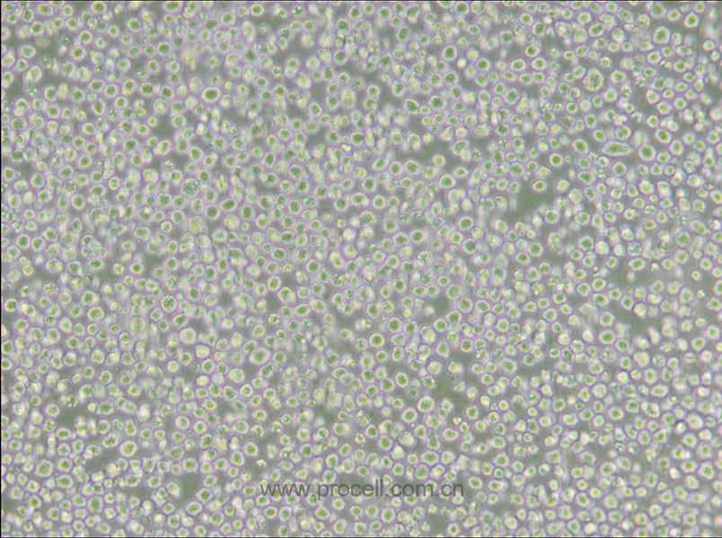 AE-1 (小鼠杂交瘤细胞(抗AChE)) (种属鉴定正确)