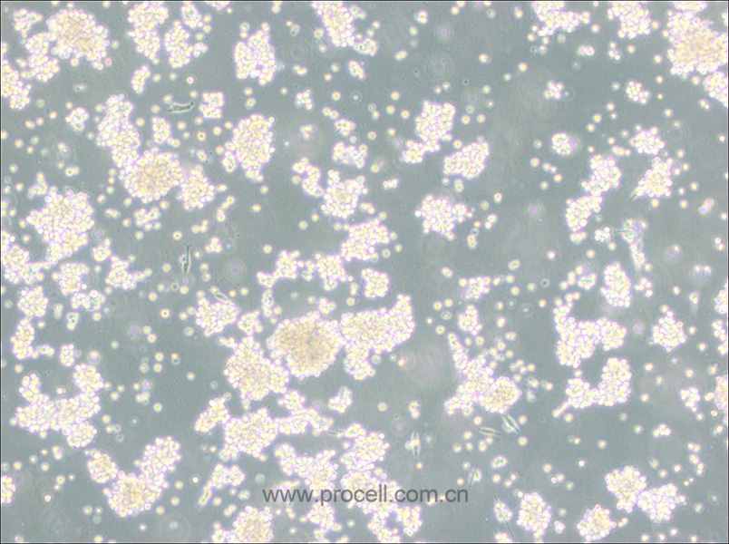 B95-8 (绒猴EB病毒转化的白细胞) (种属鉴定正确)