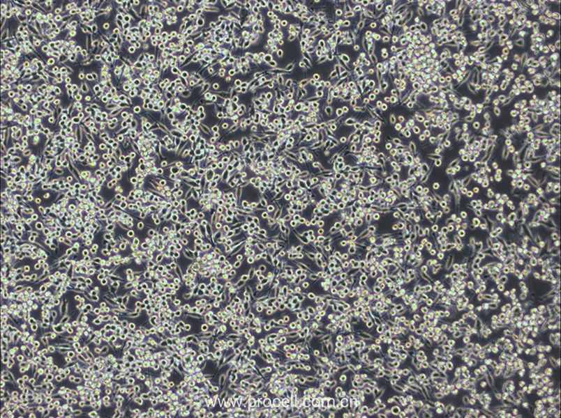 BV2 (小鼠小胶质细胞) (DMEM) (STR鉴定正确)